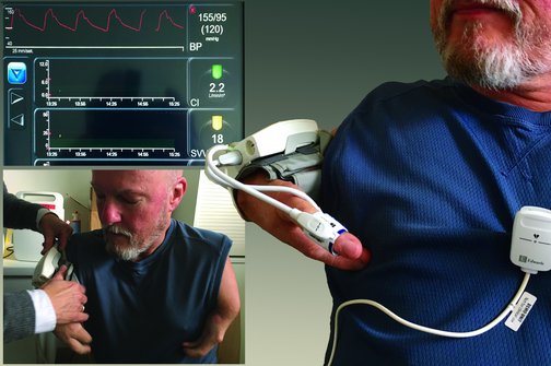 Das Bild zeigt eine Blutdruckmessung bei einem Menschen mit Conterganschädigung